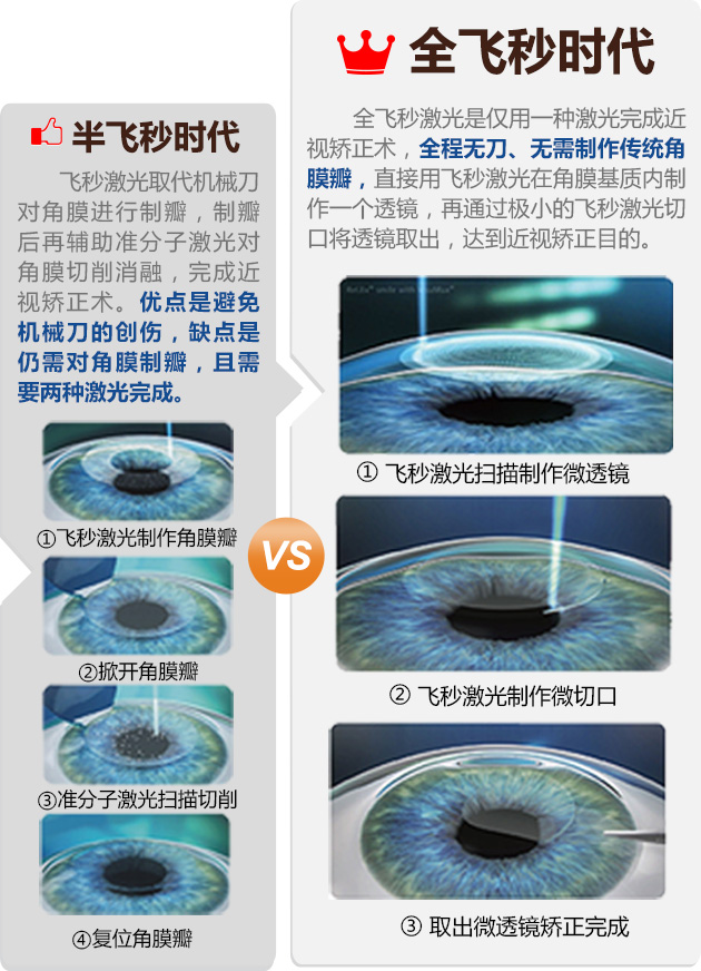 飞秒激光差异